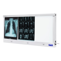 Negatoskopy slim LED NGP Negatoskopy slim LED NGP